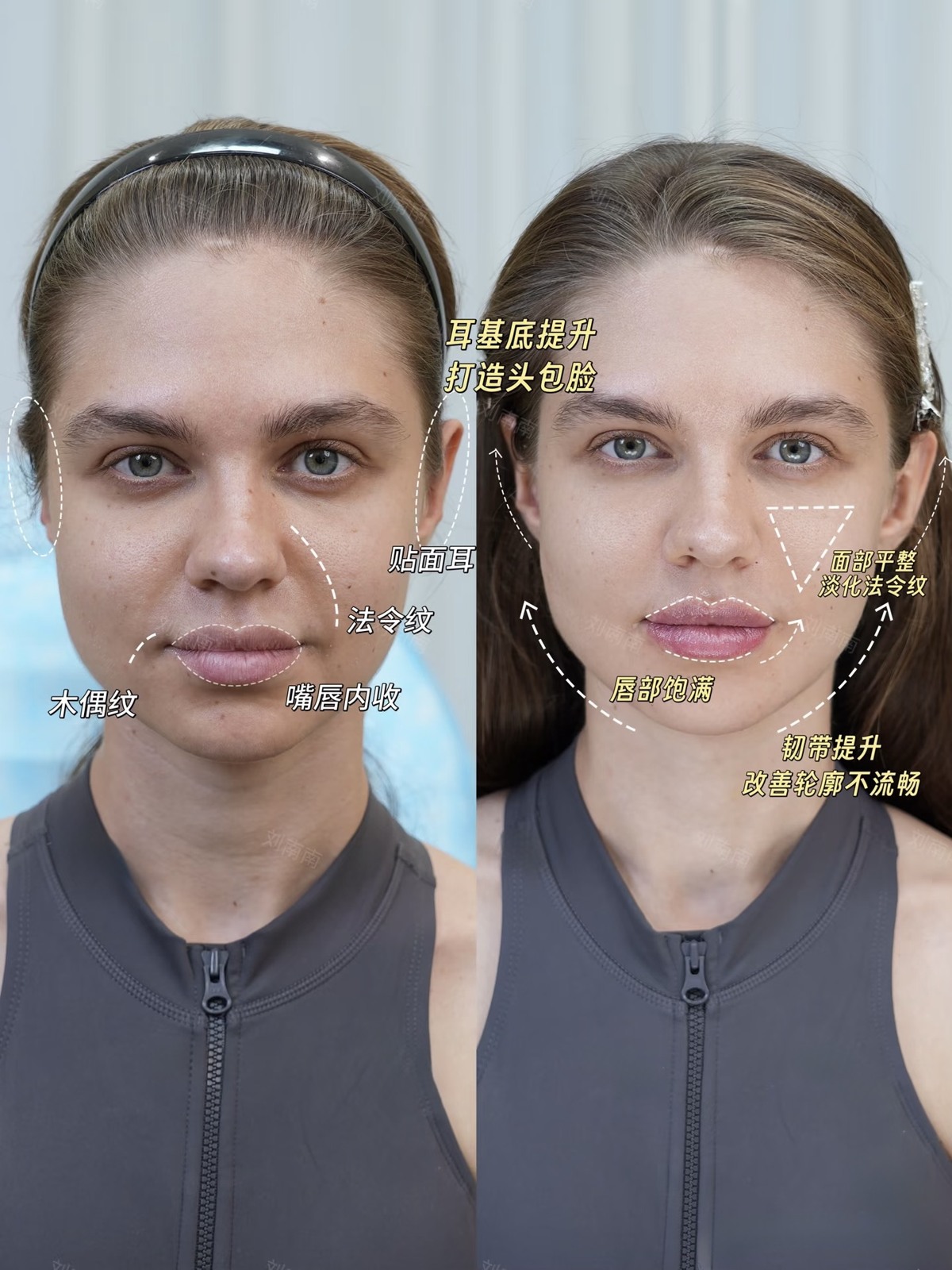 Before and after comparison 02