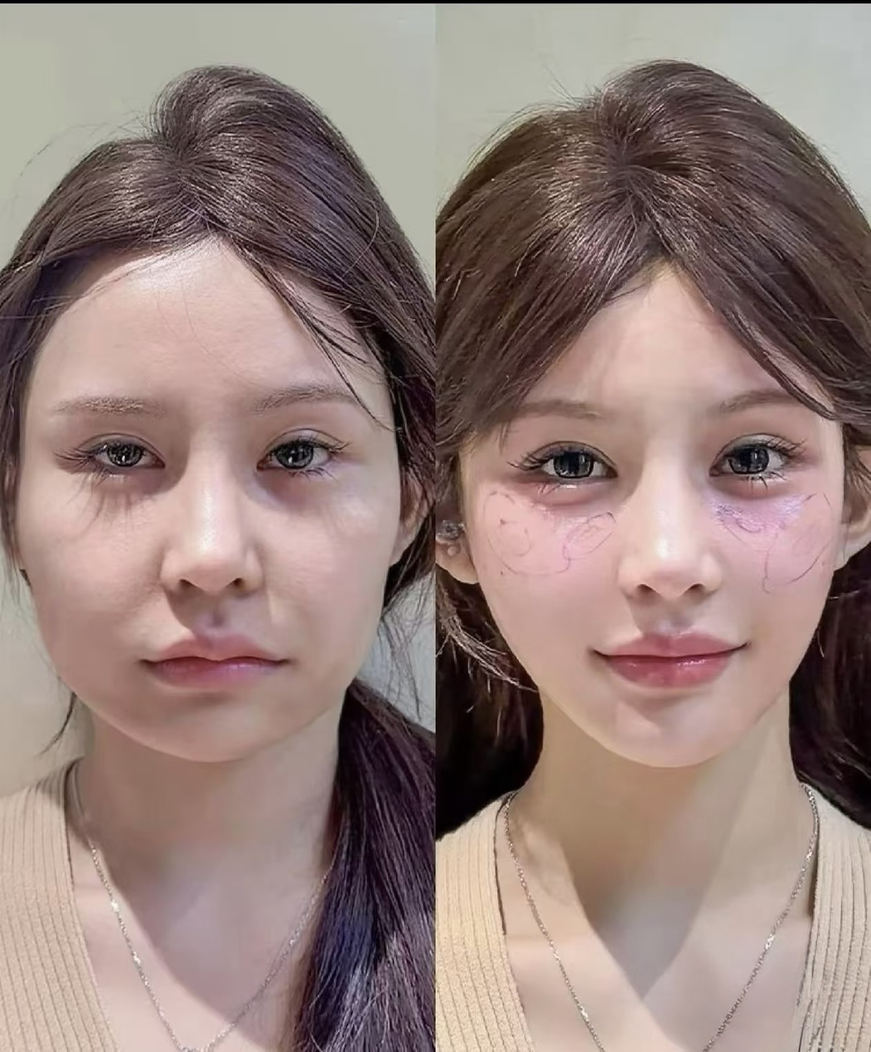Before and after comparison 03