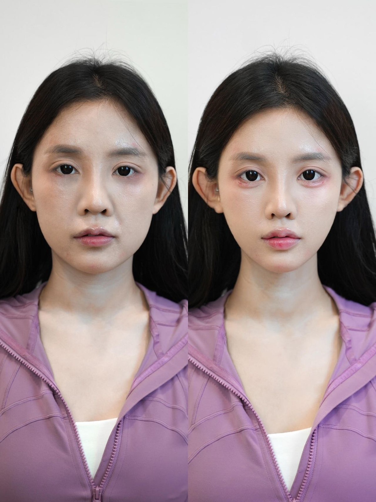 Before and after comparison 05