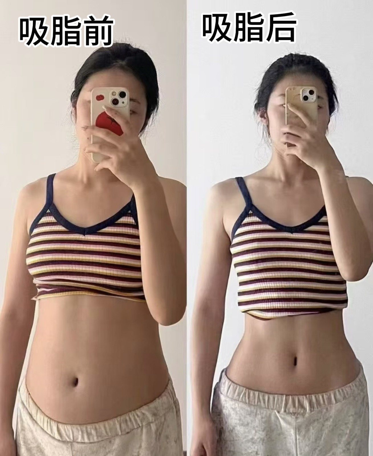 Before and after comparison 06
