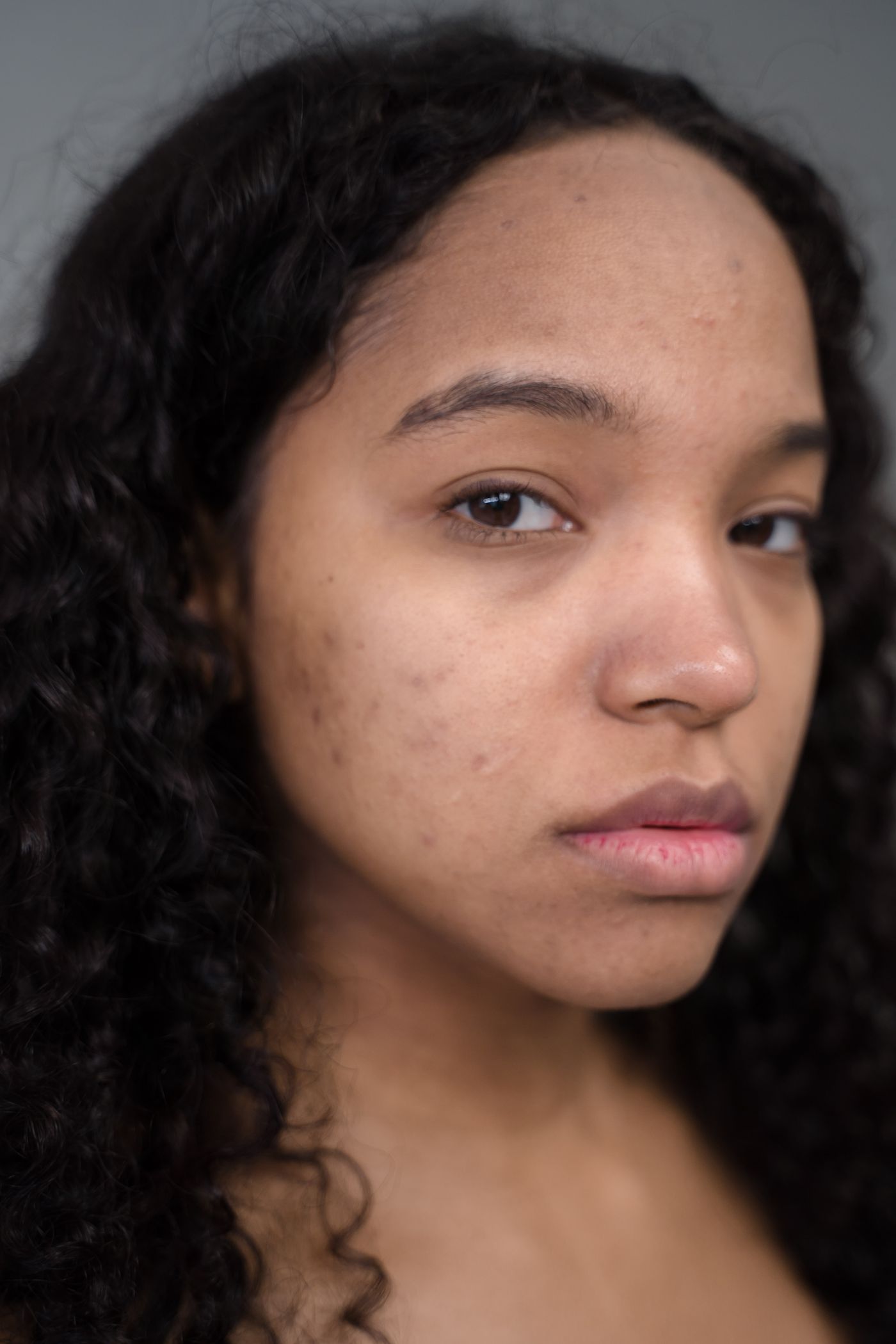 Facial lifting